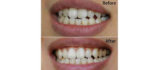 best cosmetic dental treatment