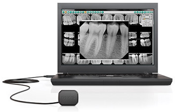 32 Smile Stone Digital X-Rays