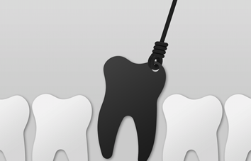 32 Smile Stone Tooth Extraction